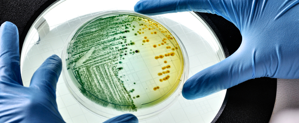 Lebensmittelmikrobiologische Analyse